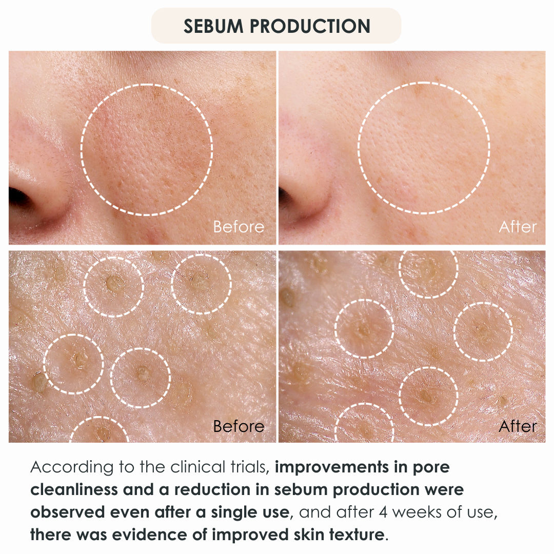 PORE NORMALIZING CLEANSER DUO -Remove Pore Clogging Dirt with Double Cleansing-