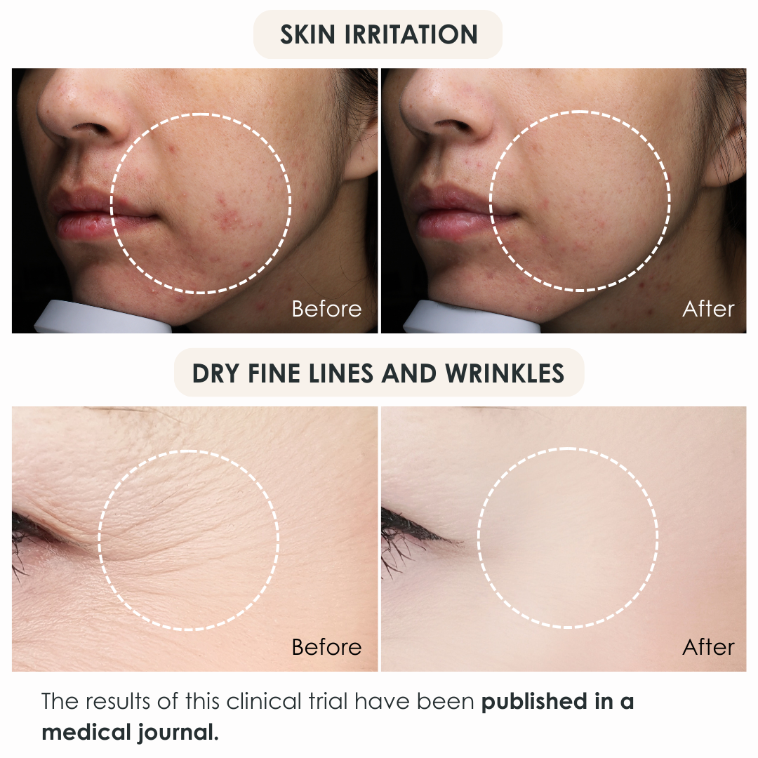 CLEAR GEL CLEANSE (3PCS) for 3 MONTHS -Gentle Makeup Remover-
