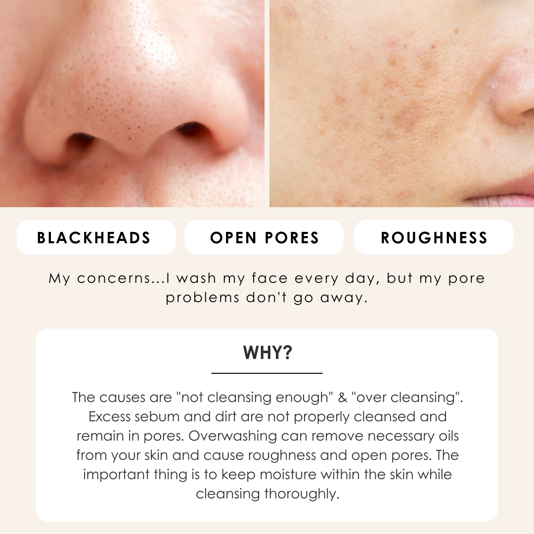 PORE NORMALIZING CLEANSER DUO -Remove Pore Clogging Dirt with Double Cleansing-