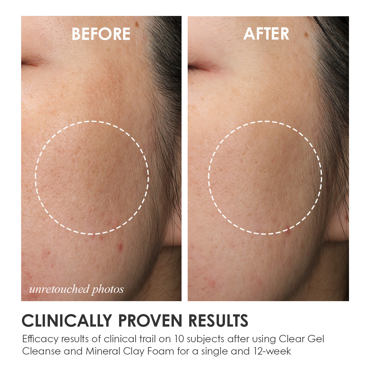 MINERAL CLAY FOAM -Foaming Mineral Cleanser-